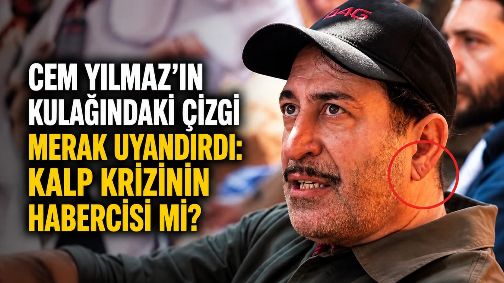 Cem Yılmaz'ın kulağındaki çizgi merak uyandırdı: Kalp krizinin habercisi mi?