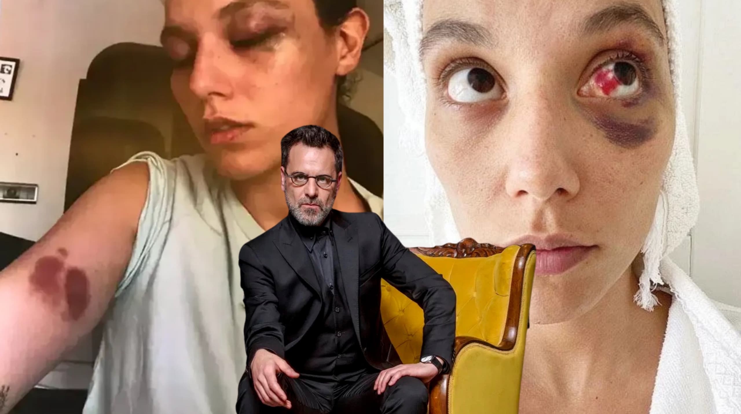 OZAN GÜVEN’İN ALZHEİMER AÇIKLAMASI GÜNDEM OLDU: “UNUTMAK İÇİN OLMUŞ OLABİLİR”